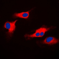 ORAOV1 Rabbit Polyclonal Antibody