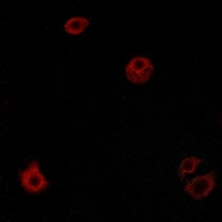 GPR110 Rabbit Polyclonal Antibody