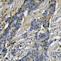 RIMKLA Rabbit Polyclonal Antibody
