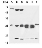 SFT2D2 Rabbit Polyclonal Antibody
