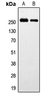 GPR179 Rabbit Polyclonal Antibody