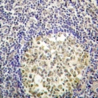 p47 phox (Phospho-S370) Antibody