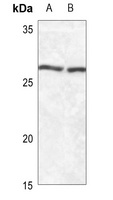 SFTPA1/2 Antibody