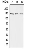 PMCA2 Rabbit Polyclonal Antibody