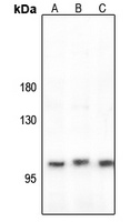 CLCN1 Rabbit Polyclonal Antibody
