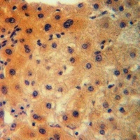 CLCN1 Rabbit Polyclonal Antibody