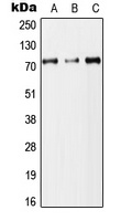 DYNC1I2 Rabbit Polyclonal Antibody