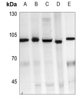 CD105 Antibody