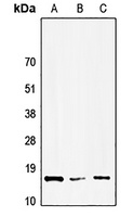 HMGN1 Rabbit Polyclonal Antibody