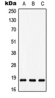 MAX (Phospho-S11) Rabbit Polyclonal Antibody