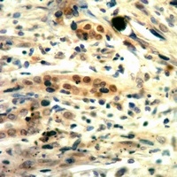 c-Met (Phospho-Y1235) Rabbit Polyclonal Antibody