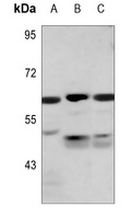 PKLR Rabbit Polyclonal Antibody