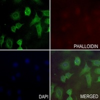 PKLR Rabbit Polyclonal Antibody