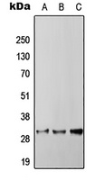 RGS4 Rabbit Polyclonal Antibody