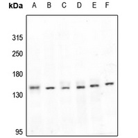 LATS1 Rabbit Polyclonal Antibody