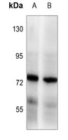 BAG3 Rabbit Polyclonal Antibody