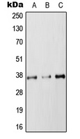 RAB36 Rabbit Polyclonal Antibody