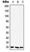 YAF2 Rabbit Polyclonal Antibody