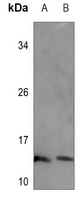 SEC61B Rabbit Polyclonal Antibody