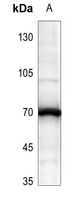 ATE1 Rabbit Polyclonal Antibody