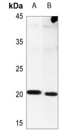 NIP7 Rabbit Polyclonal Antibody