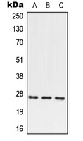 PRRX2 Rabbit Polyclonal Antibody
