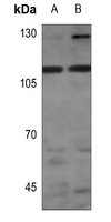 STK31 Rabbit Polyclonal Antibody
