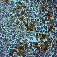 STK31 Rabbit Polyclonal Antibody