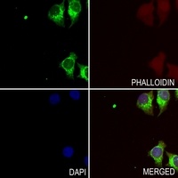 Resistin Rabbit Polyclonal Antibody