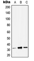 ZMAT3 Rabbit Polyclonal Antibody