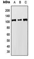 MCM8 Rabbit Polyclonal Antibody