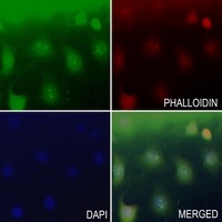 NAV3 Rabbit Polyclonal Antibody