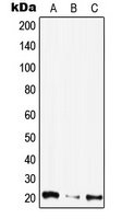 CIB4 Rabbit Polyclonal Antibody