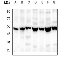 RGMB Rabbit Polyclonal Antibody