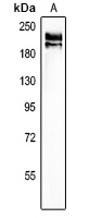 Agrin Rabbit Polyclonal Antibody