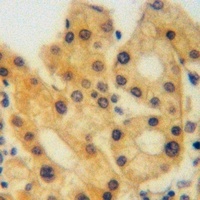Agrin Rabbit Polyclonal Antibody