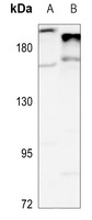 Complement C4A/B Rabbit Polyclonal Antibody