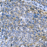 ACC alpha Rabbit Polyclonal Antibody