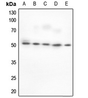 BAF53A Rabbit Polyclonal Antibody
