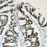 BAF53A Rabbit Polyclonal Antibody