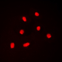 BAF53A Rabbit Polyclonal Antibody