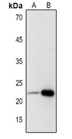 Adrenomedullin Rabbit Polyclonal Antibody