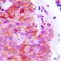Alpha-2C Adrenergic Receptor Rabbit Polyclonal Antibody