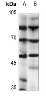 Beta-2 Adrenergic Receptor Rabbit Polyclonal Antibody