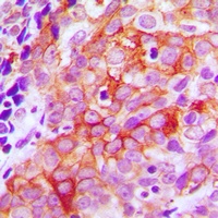 Beta-2 Adrenergic Receptor Rabbit Polyclonal Antibody