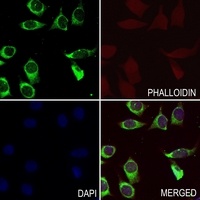 Beta-2 Adrenergic Receptor Rabbit Polyclonal Antibody
