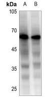 Beta-2 Adrenergic Receptor Rabbit Polyclonal Antibody