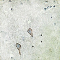 Beta-2 Adrenergic Receptor Rabbit Polyclonal Antibody