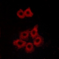 APJ Rabbit Polyclonal Antibody