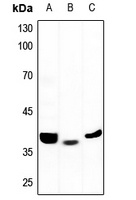 ALDOB Rabbit Polyclonal Antibody